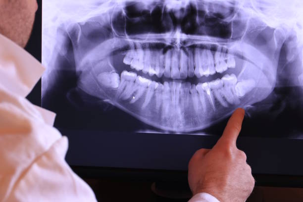 Best Emergency Treatment for Jaw Pain or Injury in Comer, GA