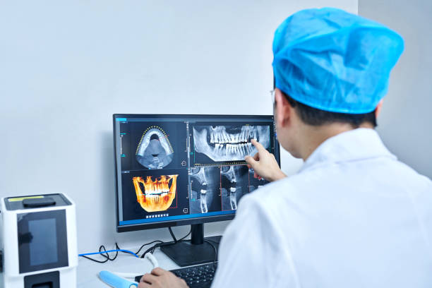 Best Knocked-Out Tooth (Avulsed Tooth) Treatment in Comer, GA
